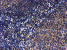 LECT2 Antibody - IHC of paraffin-embedded Human tonsil using anti-LECT2 mouse monoclonal antibody.