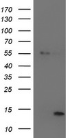 LECT2 Antibody - HEK293T cells were transfected with the pCMV6-ENTRY control (Left lane) or pCMV6-ENTRY LECT2 (Right lane) cDNA for 48 hrs and lysed. Equivalent amounts of cell lysates (5 ug per lane) were separated by SDS-PAGE and immunoblotted with anti-LECT2.