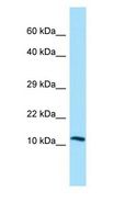 LECT2 Antibody - LECT2 antibody Western Blot of HepG2.  This image was taken for the unconjugated form of this product. Other forms have not been tested.