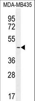 LEF1 Antibody - LEF1 Antibody western blot of MDA-MB435 cell line lysates (35 ug/lane). The LEF1 antibody detected the LEF1 protein (arrow).