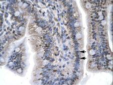 LEF1 Antibody - LEF1 antibody ARP32403_T100-NP_057353-LEF1 (lymphoid enhancer-binding factor 1) Antibody was used in IHC to stain formalin-fixed, paraffin-embedded human intestine.  This image was taken for the unconjugated form of this product. Other forms have not been tested.