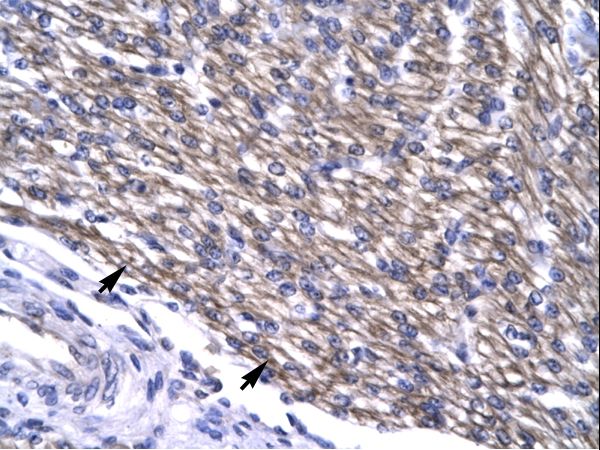 LEF1 Antibody - Human Heart.  This image was taken for the unconjugated form of this product. Other forms have not been tested.