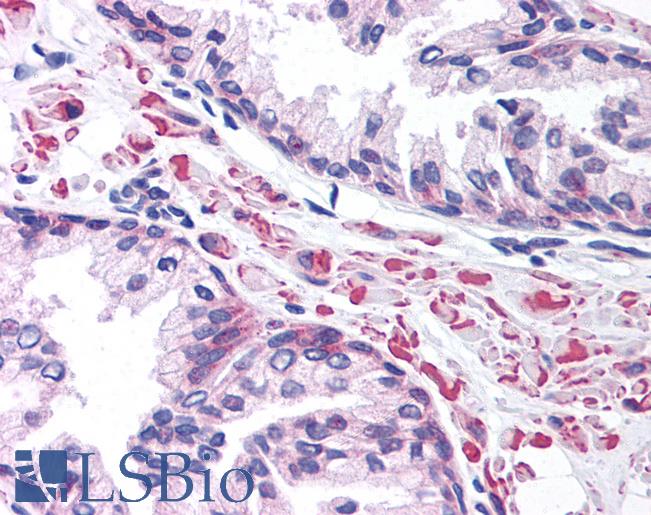 LEF1 Antibody - Anti-LEF1 antibody IHC of human prostate. Immunohistochemistry of formalin-fixed, paraffin-embedded tissue after heat-induced antigen retrieval. Antibody concentration 5 ug/ml.  This image was taken for the unconjugated form of this product. Other forms have not been tested.