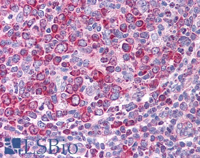 LEF1 Antibody - Anti-LEF1 antibody IHC of human tonsil. Immunohistochemistry of formalin-fixed, paraffin-embedded tissue after heat-induced antigen retrieval. Antibody concentration 5 ug/ml.  This image was taken for the unconjugated form of this product. Other forms have not been tested.