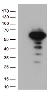 LEF1 Antibody - HEK293T cells were transfected with the pCMV6-ENTRY control. (Left lane) or pCMV6-ENTRY LEF1. (Right lane) cDNA for 48 hrs and lysed. Equivalent amounts of cell lysates. (5 ug per lane) were separated by SDS-PAGE and immunoblotted with anti-LEF1. (1:500)