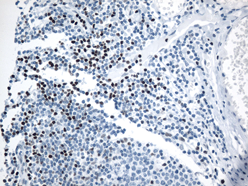 LEF1 Antibody - Immunohistochemical staining of paraffin-embedded Human tonsil within the normal limits using anti-LEF1 mouse monoclonal antibody. (Heat-induced epitope retrieval by 1mM EDTA in 10mM Tris buffer. (pH8.5) at 120°C for 3 min. (1:500)