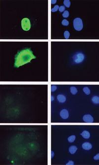 LEF1 Antibody - Immunofluorescence staining of Cos-1 cells transfected with (top to bottom) full length hLEF-1, a LEF-1 mutant missing the nuclear localization signal, TCF-4 and TCF-1. Cells were stained with LEF-1 antibody, clone REMB1 and visualized with FITC conjugated mouse IgG. DAPI was used to detect all nuclei. The LEF-1 clone REMB1 recognized an epitope in the beta catenin binding domain that is present only in LEF-1.