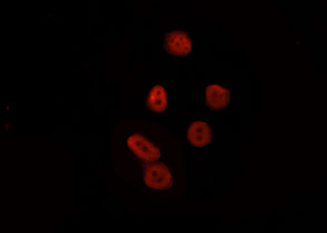 LEF1 Antibody - Staining HepG2 cells by IF/ICC. The samples were fixed with PFA and permeabilized in 0.1% Triton X-100, then blocked in 10% serum for 45 min at 25°C. The primary antibody was diluted at 1:200 and incubated with the sample for 1 hour at 37°C. An Alexa Fluor 594 conjugated goat anti-rabbit IgG (H+L) Ab, diluted at 1/600, was used as the secondary antibody.