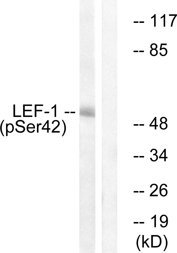 LEF1 Antibody - Western blot analysis of lysates from 293 cells treated with paclitaxel 1uM 24h, using LEF-1 (Phospho-Ser42) Antibody. The lane on the right is blocked with the phospho peptide.