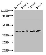 LEFTYB / LEFTY1 Antibody - Positive WB detected in:Rat spleen tissue,Mouse heart tissue,Mouse liver tissue,Mouse brain tissue;All lanes:LEFTY1 antibody at 2.7?g/ml;Secondary;Goat polyclonal to rabbit IgG at 1/50000 dilution;Predicted band size: 41 KDa;Observed band size: 41 KDa;