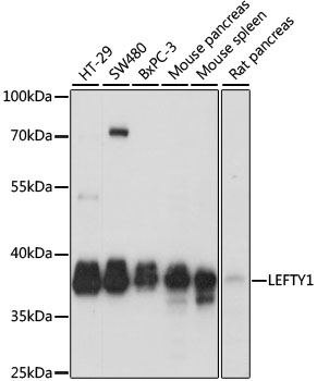 LEFTYB / LEFTY1 Antibody - Western blot analysis of extracts of various cell lines, using LEFTY1 antibody at 1:1000 dilution. The secondary antibody used was an HRP Goat Anti-Rabbit IgG (H+L) at 1:10000 dilution. Lysates were loaded 25ug per lane and 3% nonfat dry milk in TBST was used for blocking. An ECL Kit was used for detection and the exposure time was 1s.