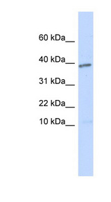 LEFTYB / LEFTY1 Antibody - LEFTY1 / Lefty antibody Western blot of Transfected 293T cell lysate. This image was taken for the unconjugated form of this product. Other forms have not been tested.