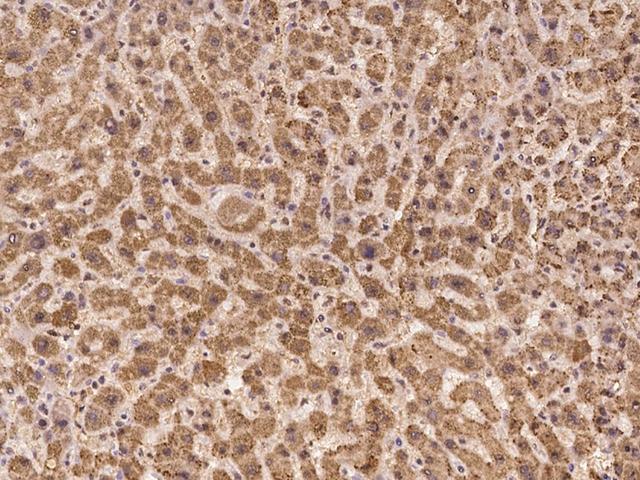 LEKR1 Antibody - Immunochemical staining of human LEKR1 in human liver with rabbit polyclonal antibody at 1:100 dilution, formalin-fixed paraffin embedded sections.