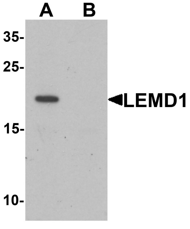 LEMD1 Antibody - Western blot analysis of LEMD1 in A20 cell lysate with LEMD1 antibody at 1 ug/ml in (A) the absence and (B) the presence of blocking peptide.