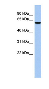 LEMD2 Antibody - LEMD2 antibody Western blot of Fetal Heart lysate. This image was taken for the unconjugated form of this product. Other forms have not been tested.