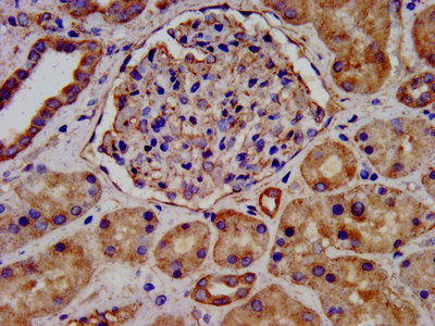 LEMD2 Antibody - Immunohistochemistry image at a dilution of 1:300 and staining in paraffin-embedded human kidney tissue performed on a Leica BondTM system. After dewaxing and hydration, antigen retrieval was mediated by high pressure in a citrate buffer (pH 6.0) . Section was blocked with 10% normal goat serum 30min at RT. Then primary antibody (1% BSA) was incubated at 4 °C overnight. The primary is detected by a biotinylated secondary antibody and visualized using an HRP conjugated SP system.