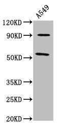 LEMD2 Antibody - Positive Western Blot detected in A549 whole cell lysate. All lanes: LEMD2 antibody at 6.95 µg/ml Secondary Goat polyclonal to rabbit IgG at 1/50000 dilution. Predicted band size: 57, 24 KDa. Observed band size: 57 KDa