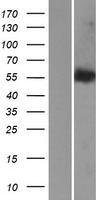 LEMD2 Protein - Western validation with an anti-DDK antibody * L: Control HEK293 lysate R: Over-expression lysate