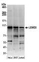 LEMD3 / MAN1 Antibody - Detection of human LEMD3 by western blot. Samples: Whole cell lysate (15 µg) from HeLa, HEK293T, and Jurkat cells prepared using NETN lysis buffer. Antibody: Affinity purified rabbit anti-LEMD3 antibody used for WB at 0.1 µg/ml. Detection: Chemiluminescence with an exposure time of 30 seconds.