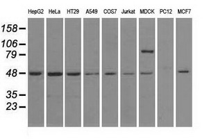 LEMD3 / MAN1 Antibody - Western blot analysis of extracts (35ug) from 9 different cell lines by using anti-LEMD3 monoclonal antibody.