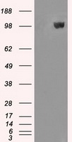 LEMD3 / MAN1 Antibody - HEK293T cells were transfected with the pCMV6-ENTRY control (Left lane) or pCMV6-ENTRY LEMD3 (Right lane) cDNA for 48 hrs and lysed. Equivalent amounts of cell lysates (5 ug per lane) were separated by SDS-PAGE and immunoblotted with anti-LEMD3.