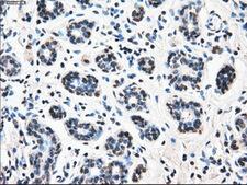 LEMD3 / MAN1 Antibody - Immunohistochemical staining of paraffin-embedded breast tissue using anti-LEMD3 mouse monoclonal antibody. (Dilution 1:50).