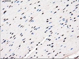 LEMD3 / MAN1 Antibody - Immunohistochemical staining of paraffin-embedded colon tissue using anti-LEMD3 mouse monoclonal antibody. (Dilution 1:50).