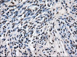 LEMD3 / MAN1 Antibody - Immunohistochemical staining of paraffin-embedded endometrium tissue using anti-LEMD3 mouse monoclonal antibody. (Dilution 1:50).