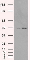 LEMD3 / MAN1 Antibody - HEK293T cells were transfected with the pCMV6-ENTRY control (Left lane) or pCMV6-ENTRY LEMD3 (Right lane) cDNA for 48 hrs and lysed. Equivalent amounts of cell lysates (5 ug per lane) were separated by SDS-PAGE and immunoblotted with anti-LEMD3.