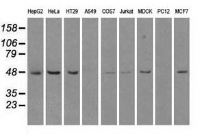 LEMD3 / MAN1 Antibody - Western blot of extracts (35 ug) from 9 different cell lines by using anti-LEMD3 monoclonal antibody.