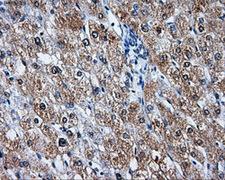 LEMD3 / MAN1 Antibody - IHC of paraffin-embedded liver tissue using anti-LEMD3 mouse monoclonal antibody. (Dilution 1:50).