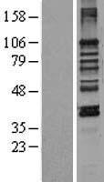 LEMD3 / MAN1 Protein - Western validation with an anti-DDK antibody * L: Control HEK293 lysate R: Over-expression lysate