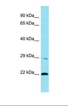 LENG1 Antibody - Western blot of Human Fetal Lung. LENG1 antibody dilution 1.0 ug/ml.  This image was taken for the unconjugated form of this product. Other forms have not been tested.