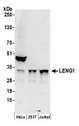 LENG1 Antibody - Detection of human LENG1 by western blot. Samples: Whole cell lysate (50 µg) from HeLa, HEK293T, and Jurkat cells prepared using NETN lysis buffer. Antibodies: Affinity purified rabbit anti-LENG1 antibody used for WB at 1 µg/ml. Detection: Chemiluminescence with an exposure time of 30 seconds.