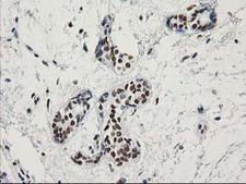 LENG1 Antibody - IHC of paraffin-embedded Human breast tissue using anti-LENG1 mouse monoclonal antibody.