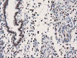 LENG1 Antibody - IHC of paraffin-embedded Human endometrium tissue using anti-LENG1 mouse monoclonal antibody.