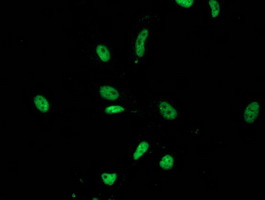 LENG1 Antibody - Immunofluorescent staining of HeLa cells using anti-LENG1 mouse monoclonal antibody.