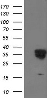 LENG1 Antibody - HEK293T cells were transfected with the pCMV6-ENTRY control (Left lane) or pCMV6-ENTRY LENG1 (Right lane) cDNA for 48 hrs and lysed. Equivalent amounts of cell lysates (5 ug per lane) were separated by SDS-PAGE and immunoblotted with anti-LENG1.