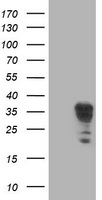 LENG1 Antibody - HEK293T cells were transfected with the pCMV6-ENTRY control (Left lane) or pCMV6-ENTRY LENG1 (Right lane) cDNA for 48 hrs and lysed. Equivalent amounts of cell lysates (5 ug per lane) were separated by SDS-PAGE and immunoblotted with anti-LENG1.