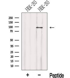 LENG8 Antibody - Western blot analysis of extracts of HEK293 cells using LENG8 antibody. The lane on the left was treated with blocking peptide.