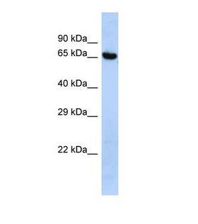 LEO1 Antibody - Western blot of Human HepG2. LEO1 antibody dilution 1.0 ug/ml.  This image was taken for the unconjugated form of this product. Other forms have not been tested.