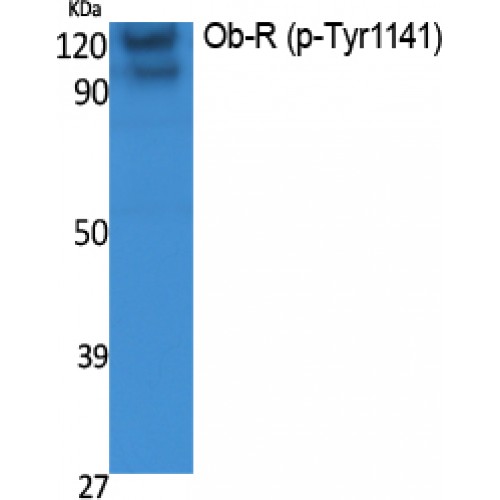LEPR / Leptin Receptor Antibody - Western blot of Phospho-Ob-R (Y1141) antibody
