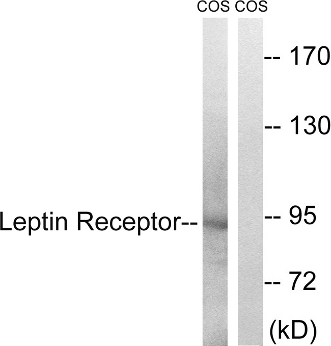 LEPR / Leptin Receptor Antibody - Western blot analysis of lysates from COS7 cells, treated with calyculinA 50ng/ml 30', using Leptin Receptor Antibody. The lane on the right is blocked with the synthesized peptide.