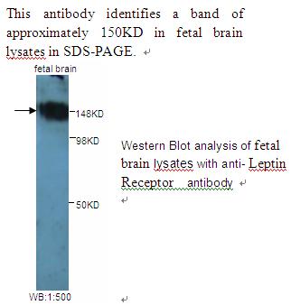 LEPR / Leptin Receptor Antibody