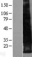 LEPROTL1 Protein - Western validation with an anti-DDK antibody * L: Control HEK293 lysate R: Over-expression lysate