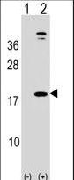 Leptin Antibody - Western blot of LEP (arrow) using rabbit polyclonal LEP Antibody. 293 cell lysates (2 ug/lane) either nontransfected (Lane 1) or transiently transfected (Lane 2) with the LEP gene.