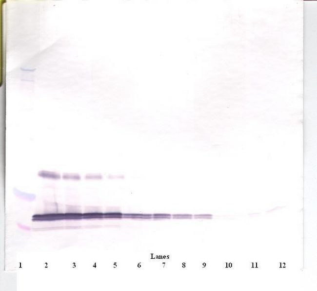 Leptin Antibody - Western Blot (reducing) of Leptin antibody. This image was taken for the unconjugated form of this product. Other forms have not been tested.
