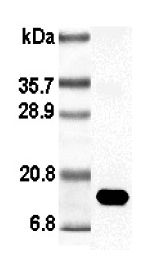 Leptin Antibody - Western blot analysis using anti-Leptin (rat), pAb at 1:5000 dilution.  This image was taken for the unconjugated form of this product. Other forms have not been tested.