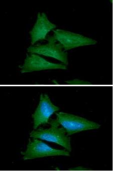 Leptin Antibody - ICC/IF analysis of Leptin in HeLa cells line, stained with DAPI (Blue) for nucleus staining and monoclonal anti-human Leptin antibody (1:100) with goat anti-mouse IgG-Alexa fluor 488 conjugate (Green).