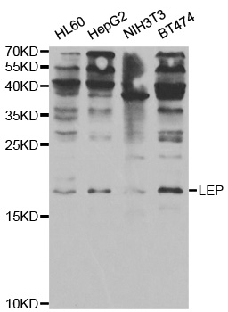 Leptin Antibody - Western blot analysis of extracts of various cell lines.